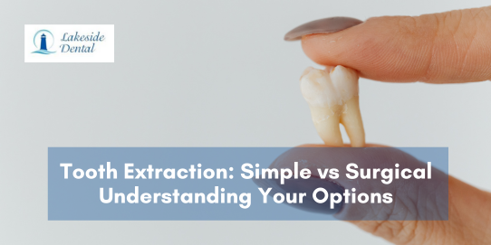Dental extraction instruments and tools used for simple and surgical tooth extractions
