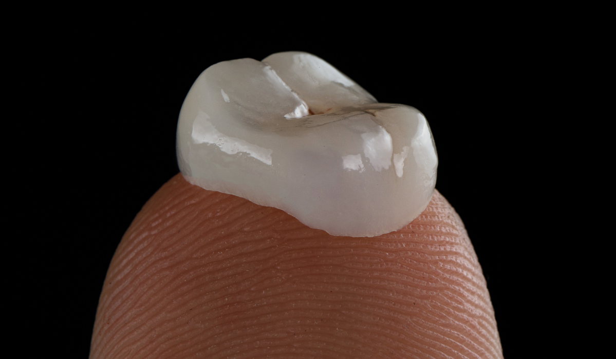 Emergency dentist at Lakeside Dental examining patient with fallen dental crown