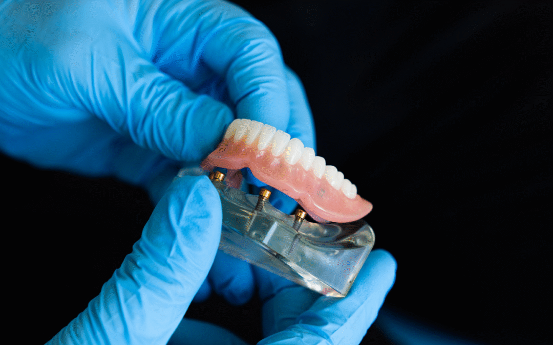 Dental Implants vs. Dentures: Making the Right Choice