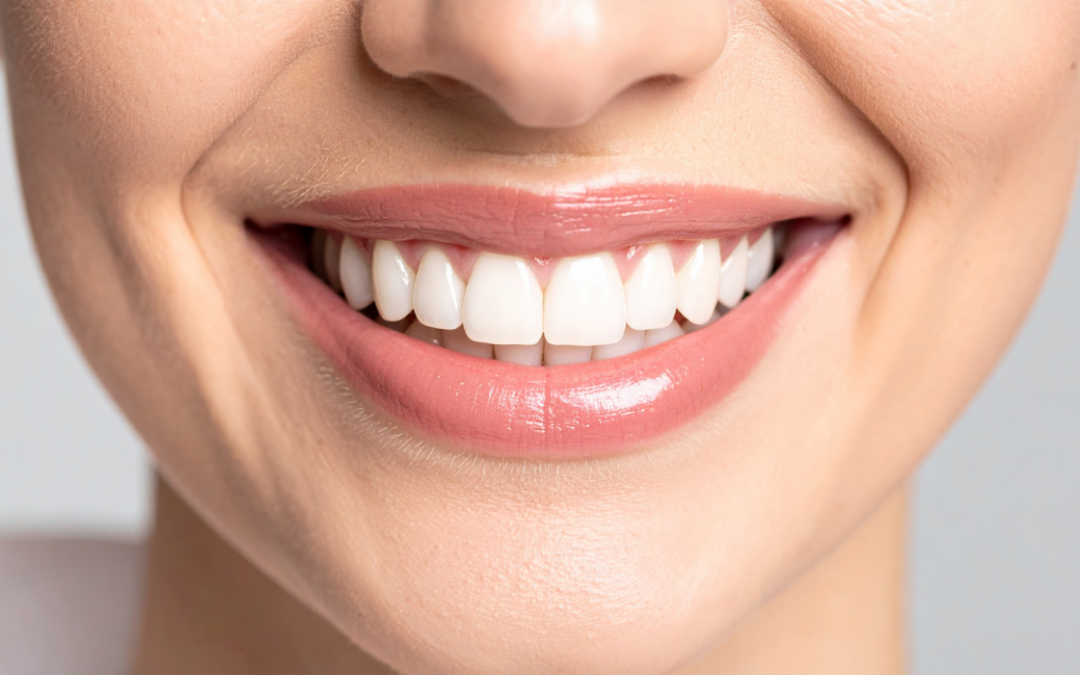 Cosmetic Dentistry: Addressing Common Smile Concerns