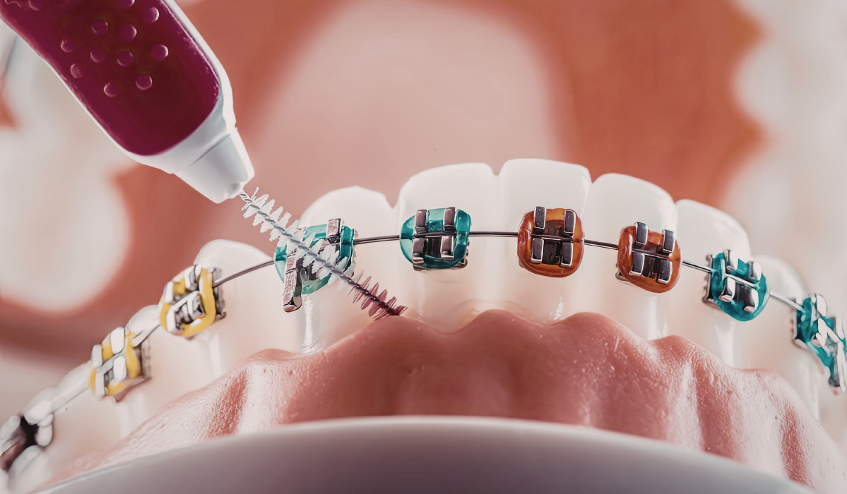 family dentist in Stoney Creek orthodontic services at Lakeside Dental